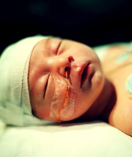 sick baby with brain injury sleeping in NICU bed with oxygen monitor and head bandages