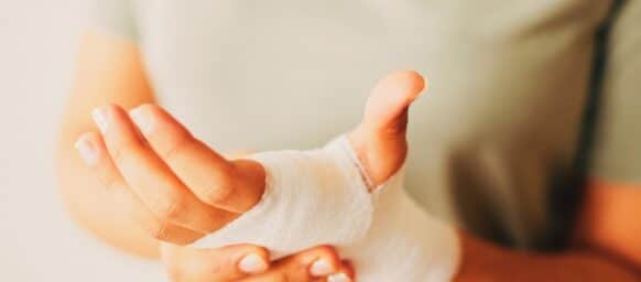 Woman with gauze bandage wrapped around her hand