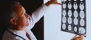 Doctor looks at brain scan images on light box. Concussions in the Workplace